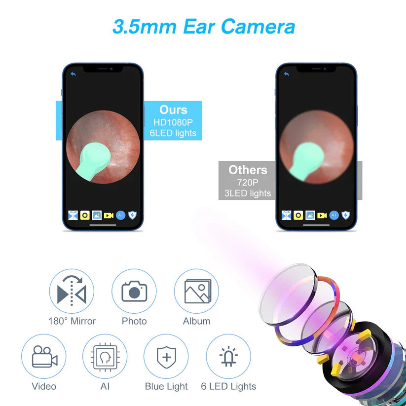 Smart ear cleaner
