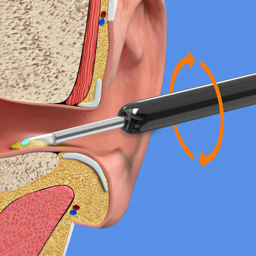 Smart ear cleaner