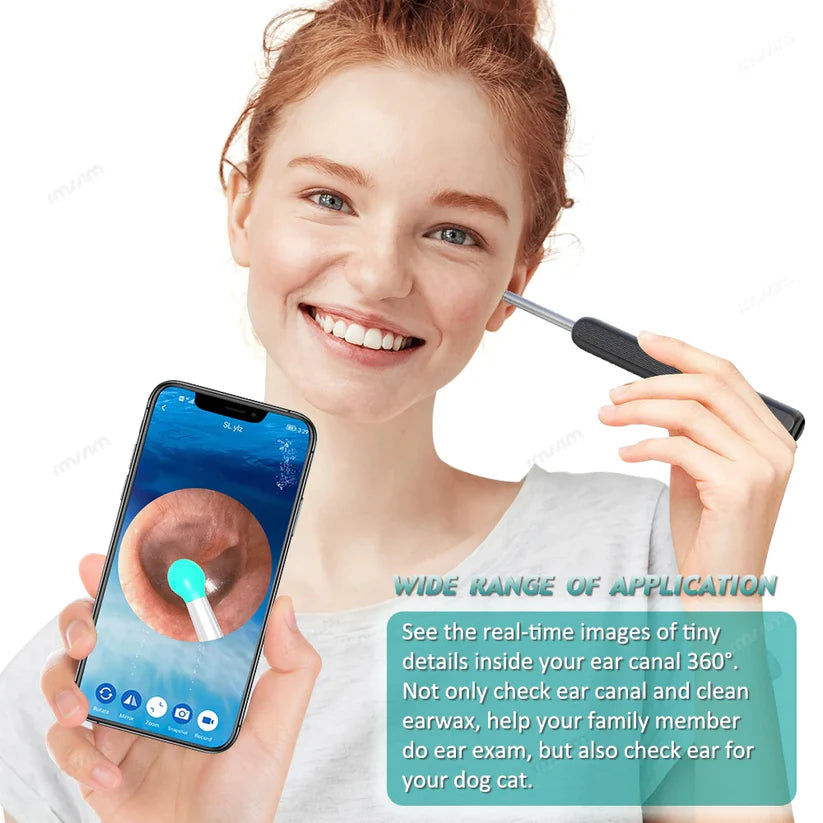 Smart ear cleaner